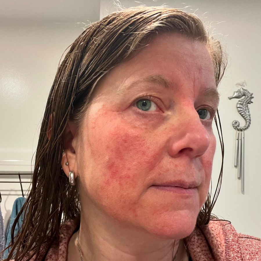 Before using Face Food